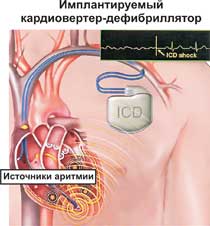 Послеоперационный период и реабилитация