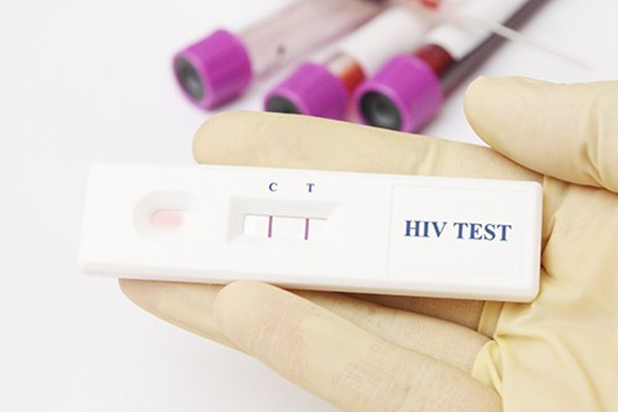 Ложноотрицательный тест на ВИЧ инфекцию: причины
